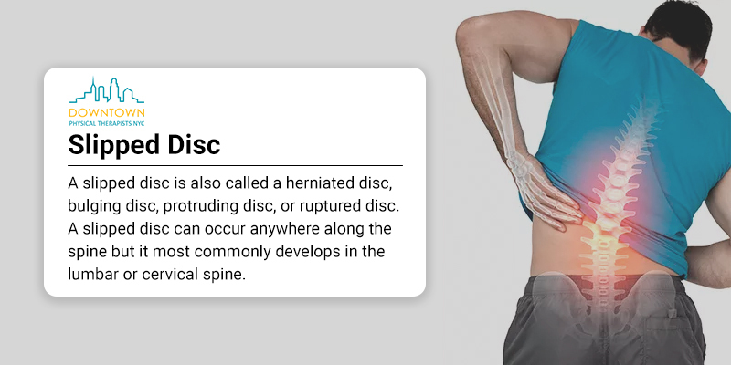 3 Signs You May Have A Slipped Disc Physical Therapists NYC