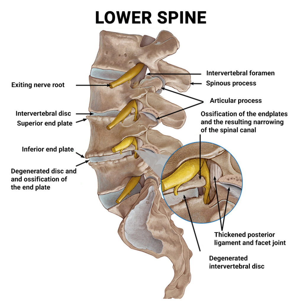 sharp-stabbing-pain-in-lower-left-side-of-back-physical-therapists-nyc