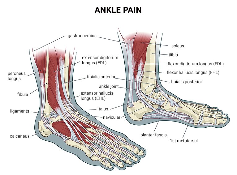 Physical Therapy For Sprained Ankle - Physical Therapists NYC