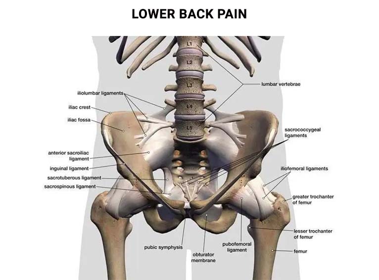 What Causes Lumbar Flank Pain? And how to release it. 