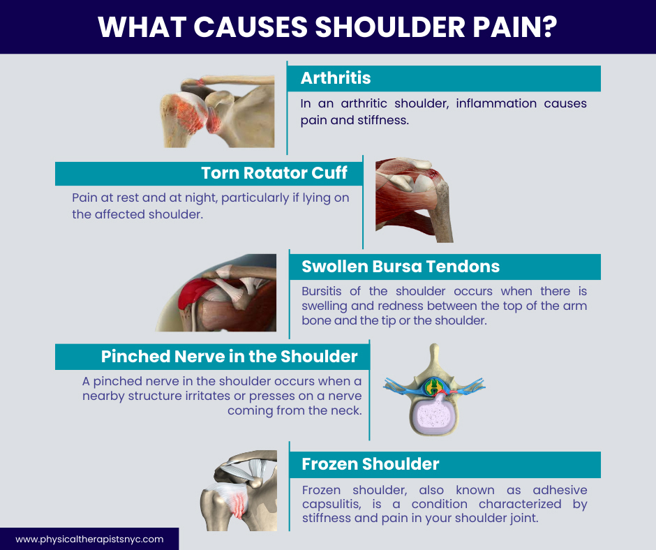 Understanding Shoulder Pain: NY Neurology Associates: Neurologists